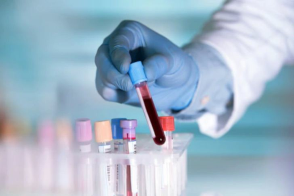 immunologie